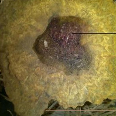 Age of the infection